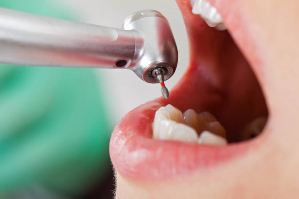 Best Emergency Care for Gum Disease in Sandusky, MI